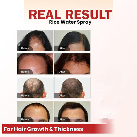 Hair Growth Spray Batana Oil Spray Natural Hair Growth Spray Hair Growth Spray Batana Oil Spray Natural Hair Growth Spray