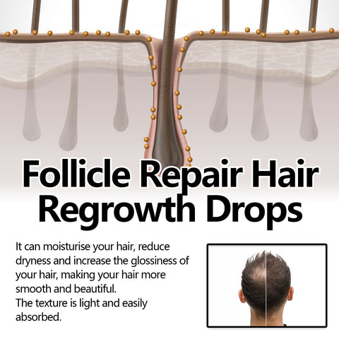 Thick Hair Hair Anti-fall Strong Hair Fixing Serums Thick Hair Hair Anti-fall Strong Hair Fixing Serums
