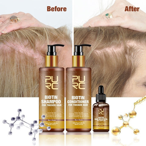 PURC Hair Care Ginger Biotin Three-piece Shampoo Conditioner Repair Dry And Frizz Essential Oil PURC Hair Care Ginger Biotin Three-piece Shampoo Conditioner Repair Dry And Frizz Essential Oil