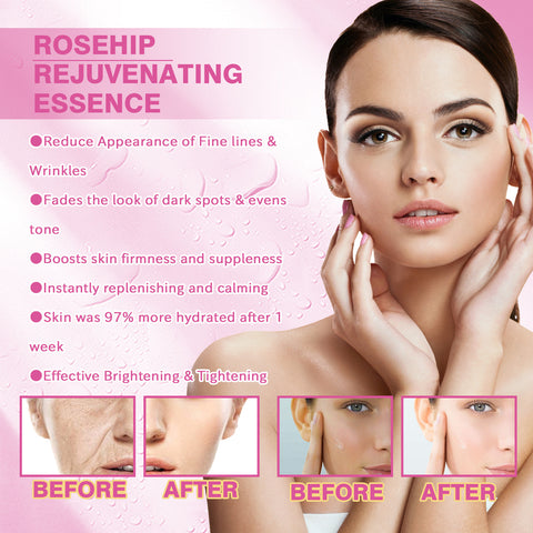 Rose Fruit Skin Rejuvenation Moisturizing Toner Rose Fruit Skin Rejuvenation Moisturizing Toner