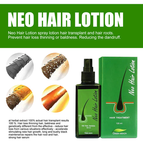 Hair Care Growth Lotion Spray Hair Care Growth Lotion Spray