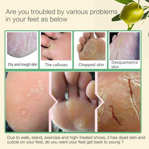 Aloe Vera Foot Mask Peeling For Legs Feet Mask Exfoliating Socks Scrub For Pedicure Anti Crack Heel Remove Skin Foot Patch Aloe Vera Foot Mask Peeling For Legs Feet Mask Exfoliating Socks Scrub For Pedicure Anti Crack Heel Remove Skin Foot Patch