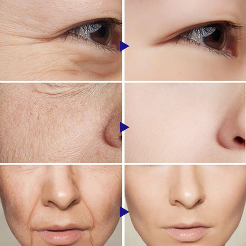 Vitamin C Serum Facial Serum Amazon Vitamin C Serum Facial Serum Amazon