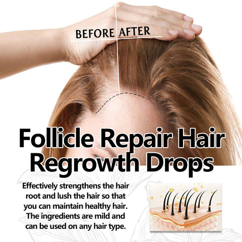 Thick Hair Hair Anti-fall Strong Hair Fixing Serums Thick Hair Hair Anti-fall Strong Hair Fixing Serums