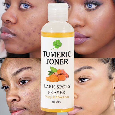 Skin Softening Lotion Removing Black Turmeric Toner Skin Softening Lotion Removing Black Turmeric Toner