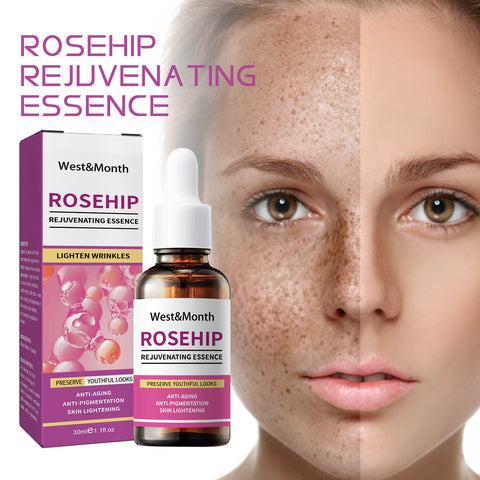 Rose Fruit Skin Rejuvenation Moisturizing Toner Rose Fruit Skin Rejuvenation Moisturizing Toner