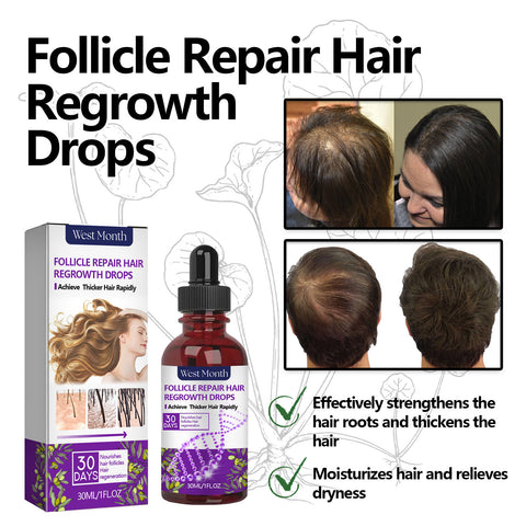 Thick Hair Hair Anti-fall Strong Hair Fixing Serums Thick Hair Hair Anti-fall Strong Hair Fixing Serums
