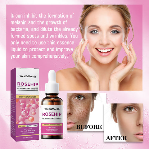 Rose Fruit Skin Rejuvenation Moisturizing Toner